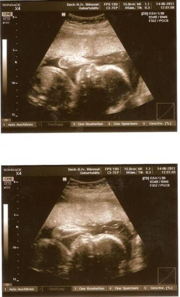 Bild zu zurück von der Vu mit blchen :-) - Forum für September - Mamis