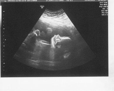 Bild zu Heute kauf ich Babysachen...und Babybild - Forum für September - Mamis