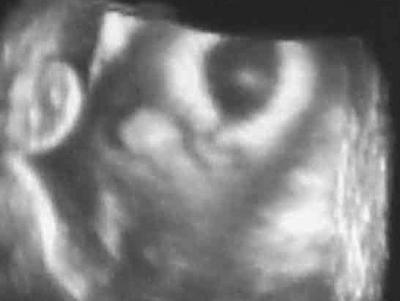 Bild zu Meld mich auch mal wieder mit Neuigkeiten:-) - Forum für September - Mamis