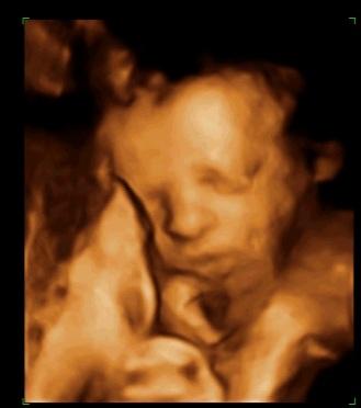 Bild zu Mal wieder melden & neue Fotos zeigen =) - Forum für September - Mamis