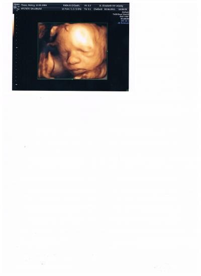 Bild zu Cristiano macht uns Kummer... :-( + 4D Bildchen - Forum für September - Mamis