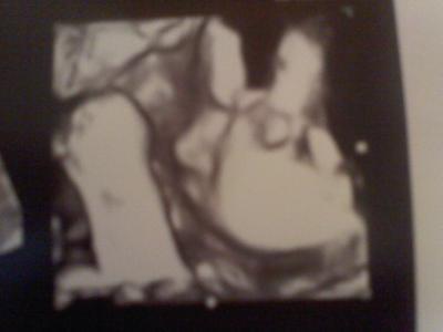 Bild zu Endlich mal ihre Maus zeigen kann^^ - Forum für September - Mamis