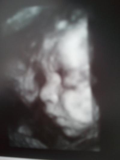 Bild zu Bericht VU + 4D Bilder + Kreissaalbesichtigung :-) - Forum für September - Mamis