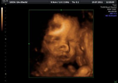 Bild zu 3D/4D US gehabt:))) - Forum für September - Mamis