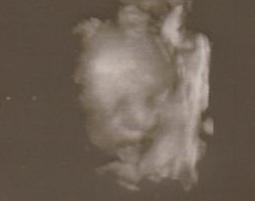 Bild zu Heute VU und gemischtes Ergebniss - Forum für September - Mamis