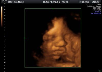 Bild zu Nochmal ein anderes 3D Bildchen:) - Forum für September - Mamis