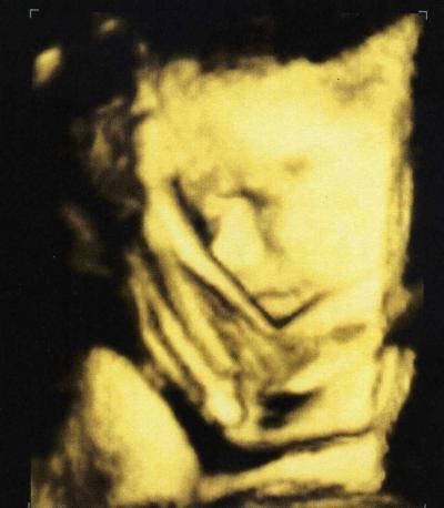 Bild zu Alles gut...:-) - Forum für September - Mamis