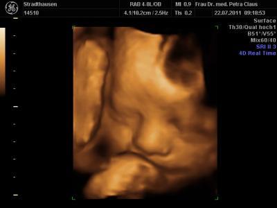 Bild zu Zurück von der VU - Forum für September - Mamis