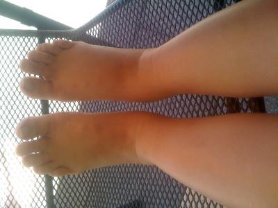 Bild zu meine Wasserbeine... - Forum für September - Mamis