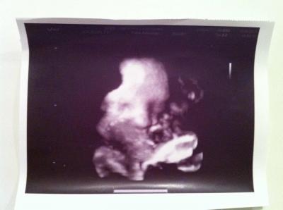 Bild zu Ein Lebenszeichen aus dem Kartondschungel - Forum für September - Mamis