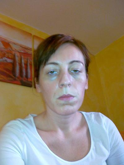 Bild zu Gibt es eigentlich schlimme bilder von euch....also während der ss? - Forum für September - Mamis