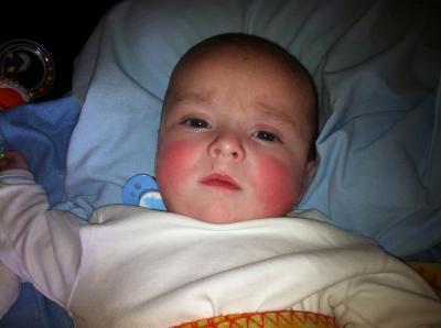 Bild zu Meinem Baby sieht man das schlimme zahnen total an :( - Forum für September - Mamis