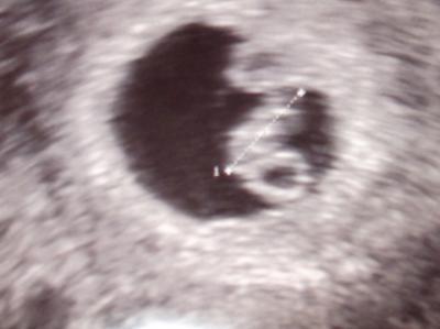 Bild zu FA-Bericht mit Bild - Forum für September - Mamis
