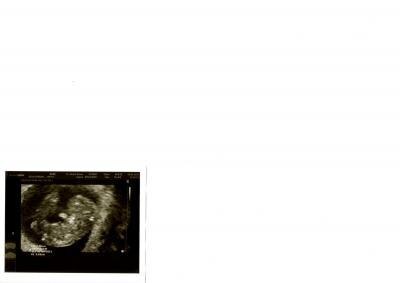 Bild zu Zurück von der VU, mit US-Bild im Gepäck:) - Forum für September - Mamis