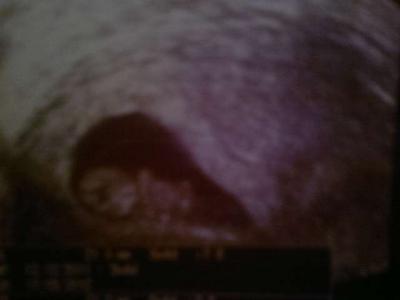 Bild zu Bild von heute - Forum für September - Mamis