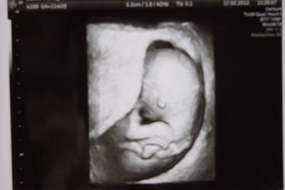 Bild zu Riesenfreude und nun Augustmama - Forum für September - Mamis