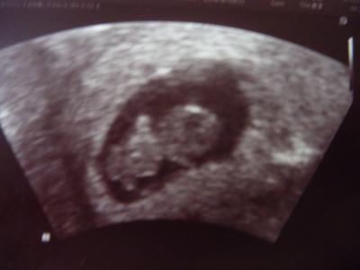 Bild zu Ich bin schon wieder da vom FA-Termin - Forum für September - Mamis