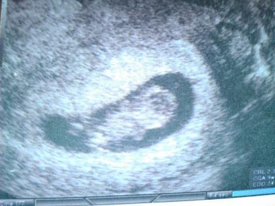 Bild zu Bericht von gestern - Forum für September - Mamis