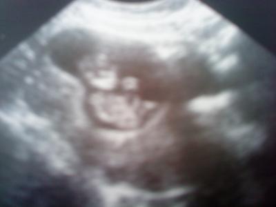 Bild zu Nachträglich ein Foto von meinem Liebling... :-) - Forum für September - Mamis