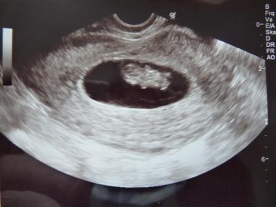 Bild zu Danke fürs Daumendrücken und Fa Bericht - Forum für September - Mamis