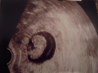 Bild zu Meine Bauchbohne - Forum für September - Mamis