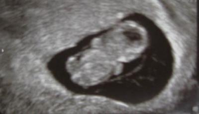 Bild zu mein kleines würmchen... - Forum für September - Mamis