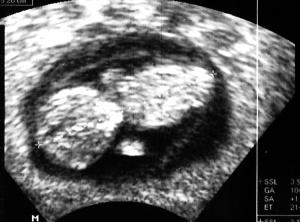 Bild zu Bild von heute & Reaktion vom großen Bruder! - Forum für September - Mamis