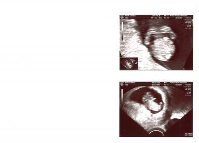 Bild zu ihr seid so super - Forum für September - Mamis