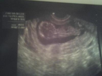 Bild zu Termin beim Fa gestern + Bild :-)  Morgen müsst ihr an mich denken! - Forum für September - Mamis