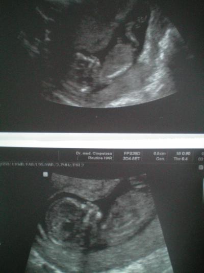 Bild zu FA-Bericht von gestern und Bilder ;-) - Forum für September - Mamis