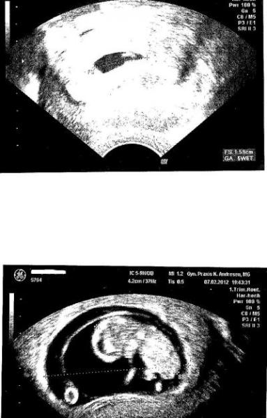 Bild zu das hat sich in 4 Wochen getan :) - Forum für September - Mamis