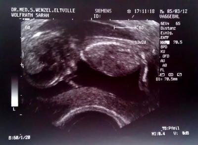 Bild zu Zurück vom Arzt :-) super glücklich und mit tollem Bildchen.... - Forum für September - Mamis