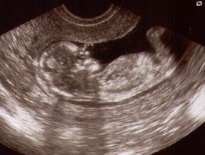 Bild zu Zurück von VU + NFM -> die Kinder durften Baby schauen :-))) - Forum für September - Mamis