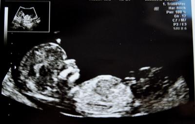 Bild zu Mag mich auch zu Euch gesellen - Forum für September - Mamis