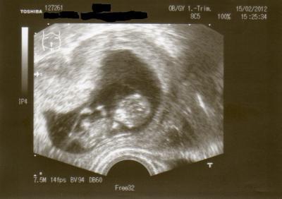 Bild zu und... - Forum für September - Mamis