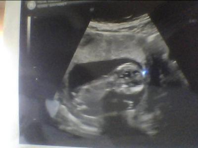 Bild zu Gestern FA-Termin und heute endlich auch 4. Monat!!! - Forum für September - Mamis