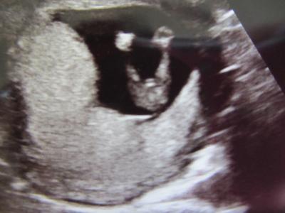 Bild zu Würde gerne Eure Meinung dazu haben!!! - Forum für September - Mamis