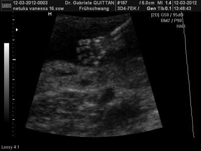 Bild zu mal was von unserem buben :-) - Forum für September - Mamis