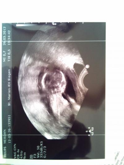 Bild zu Zurück vom KH ohne Outing! - Forum für September - Mamis