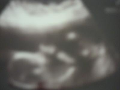 Bild zu Gestern FA Termin mit vorsichtigem Outing! - Forum für September - Mamis