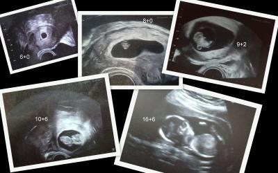 Bild zu Start neuer Fotorunde von..... - Forum für September - Mamis