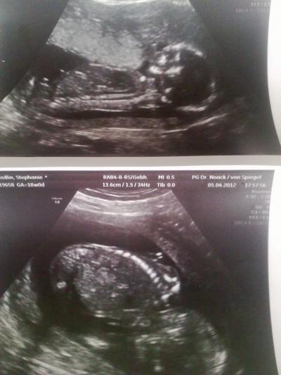 Bild zu Neue Ultraschallbilder :) - Forum für September - Mamis