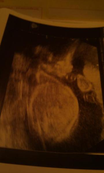 Bild zu Zurück vom Frauenarzt und cooles Foto! - Forum für September - Mamis