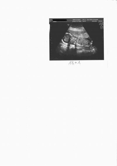 Bild zu außerplanmäßiger FA Termin + 3 US Fotos - Forum für September - Mamis