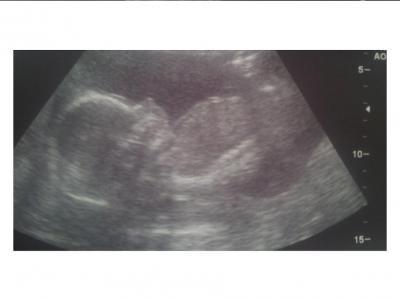 Bild zu ich weiß es - Forum für September - Mamis