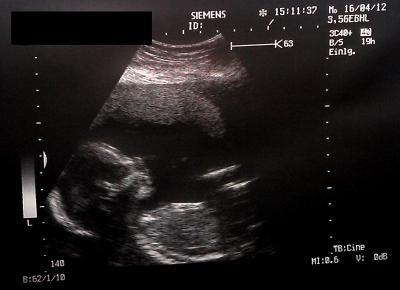 Bild zu Mit etwas Verzögerung, zurück vom Frauenarzt :-) + Bildchen - Forum für September - Mamis