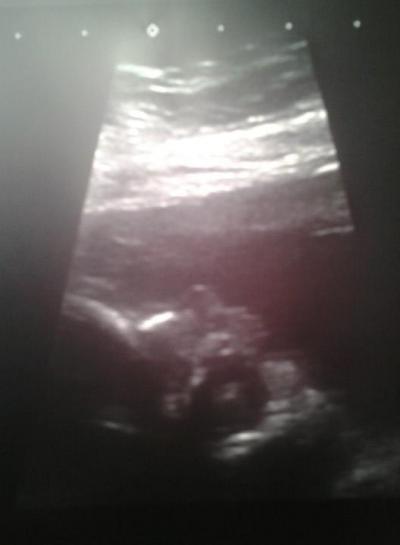 Bild zu zurück von der feindiagn+ outing+bild :-))))))) - Forum für September - Mamis