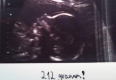 Bild zu Kräftiger Tritt - Forum für September - Mamis