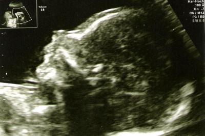 Bild zu FD-Bericht und ENDLICH Outing! - Forum für September - Mamis