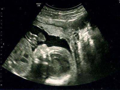 Bild zu Viel passiert am Wochenende :) + Bilder - Forum für September - Mamis